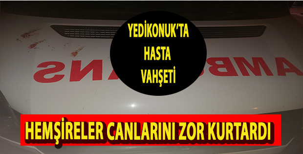 İki hemşire feci şekilde darp edildi!