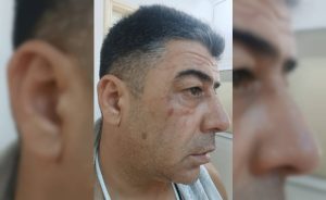 Parasını İstedi, Darp Edildi!