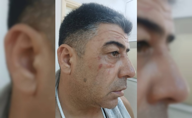 Parasını İstedi, Darp Edildi!