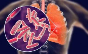 Tabipler Birliği, öğrenci ve çalışma izinlerinde verem taraması için “PPD testi şartı” aranmasını istedi