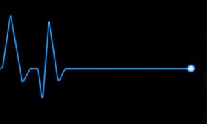 Selçuk Nadıç’ın ölüm sebebi “masif pulmoner emboli”